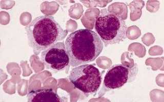 Что означают моноциты в анализе крови