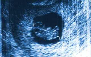 Мониторинг беременности: копчико-теменной размер плода (КТР) и его норма