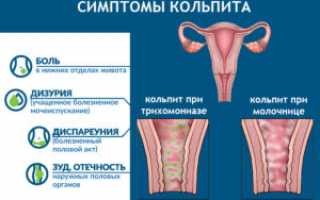 Обзор неспецифических и специфических воспалительных заболеваний женских половых органов