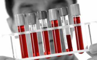 Показывает ли общий анализ крови инфекцию ВИЧ