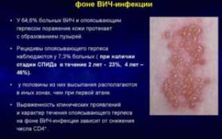 Взаимосвязь инфекций герпеса и вируса иммунодефицита