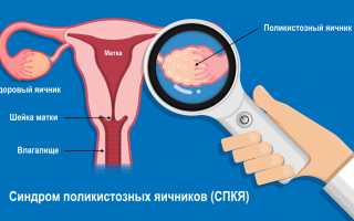 Норма и повышение фолликулостимулирующего гормона у женщин