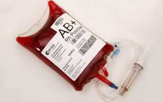 Антигенные системы крови