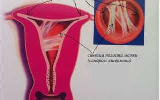Особенности появления коричневых и кровянистых выделений после аборта