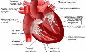 Дтлж (дополнительная трабекула в левом желудочке) сердца: что это такое?