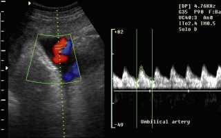 Что такое допплерометрия маточных артерий и плацентарно-плодового кровотока при беременности