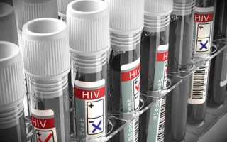 Показатели и расшифровка анализов на ВИЧ