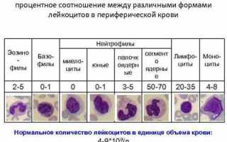 Лейкоцитарная формула крови: расшифровка результатов анализов у детей, норма в таблице