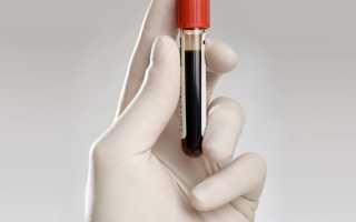 Mpv (средний объем тромбоцитов) в крови: что это такое, нормы по возрастам, причины отклонений