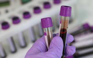 Сколько дней делается анализ биохимического состава крови, и для чего он нужен?