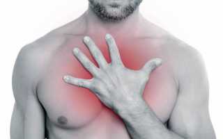 Боль посередине грудной клетки: причины и симптомы