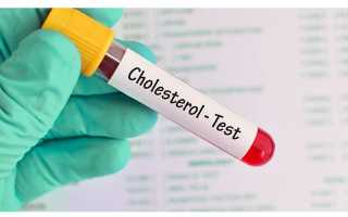 Основные и дополнительные анализы при повышенном холестерине