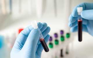 Причины повышения ГГТ в крови и способы нормализации