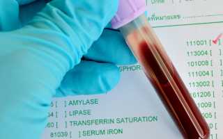 Анализ азота мочевины в крови