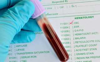 Что такое гематокрит в анализе крови понижен