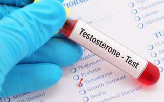 Анализ на тестостерон