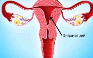 Что означает неоднородная структура эндометрия матки?