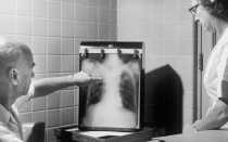 Изобретение рентгеновского излучения