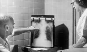 Изобретение рентгеновского излучения