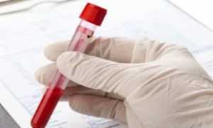 Анализ крови оак расшифровка