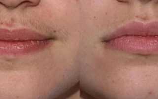 Тайны восковой депиляции верхней губы: пошаговая инструкция по удалению усиков на лице с помощью воска