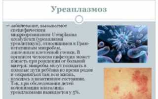 ЗППП: симптомы, бактериальные, вирусные инфекции, трихомониаз, уреаплазма и микоплазма