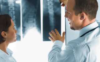 Как отсканировать снимки МРТ или рентгена