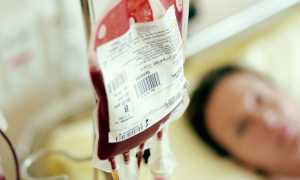 Расчет кровопотери по гемоглобину