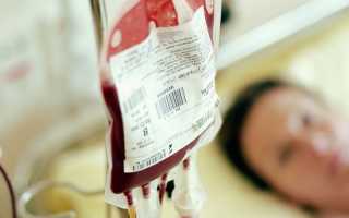 Расчет кровопотери по гемоглобину