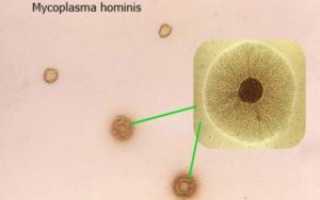 Что такое микоплазма хоминис (mycoplasma hominis)?