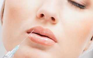 Причины и способы устранения отечности после увеличения губ