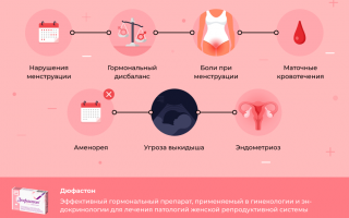 Как принимают Дюфастон при планировании беременности