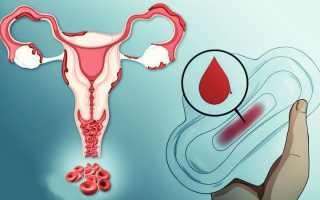 Кровит шейка матки: вероятные причины кровотечения, как остановить, советы гинекологов