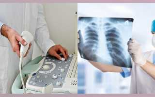 Особенности одновременного проведения УЗИ и рентгена