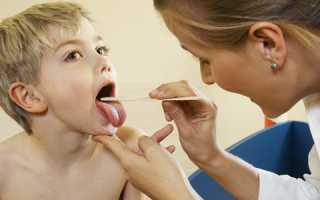 Лечение герпесной ангины у детей