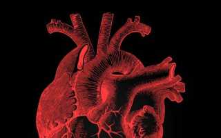 Дополнительная хорда в левом желудочке сердца
