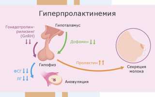 Ановуляция – месячные без овуляции