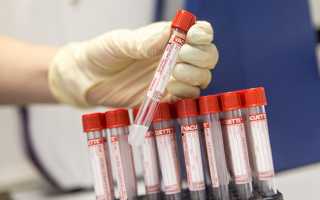 Изменение показателей крови при онкологии: как расшифровать анализы