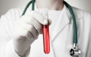 Что входит в общетерапевтический биохимический анализ крови: стандарт