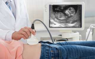 Важные показатели УЗИ при беременности: нормы и патологии