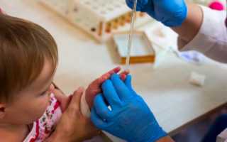 Общий анализ крови у детей: расшифровка результатов