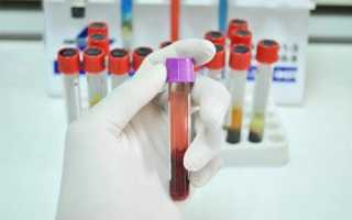 Анализ крови биохимия расшифровка у взрослых норма