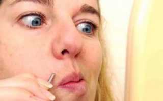 Как избавиться от усиков: лазерная эпиляция верхней губы