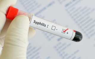 Серологическая диагностика сифилиса
