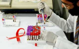 Когда будет изобретена вакцина от ВИЧ