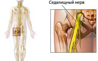 Всё об ишиалгии сидалищного нерва здесь