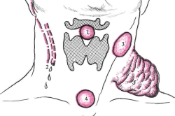 Возникновение шишек при зоглоточном абсцессе Возникновение шишек при зоглоточном абсцессе